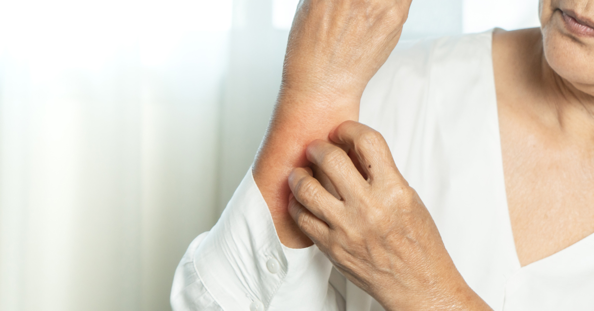 Skin Conditions Linked With Sleep Apnea